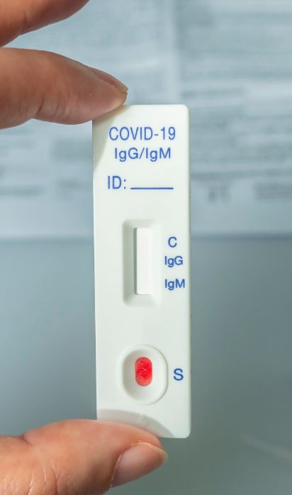 Aprobada la venta sin receta de test Covid en las farmacias